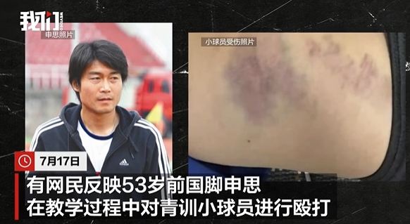 申思掌掴小球员事件：俱乐部称其顾问身份，家长已报警